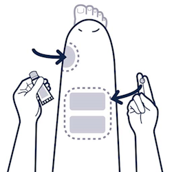 setup-conductive-gel-right.png