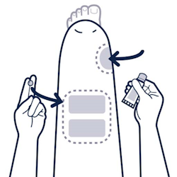 setup-conductive-gel-left.png